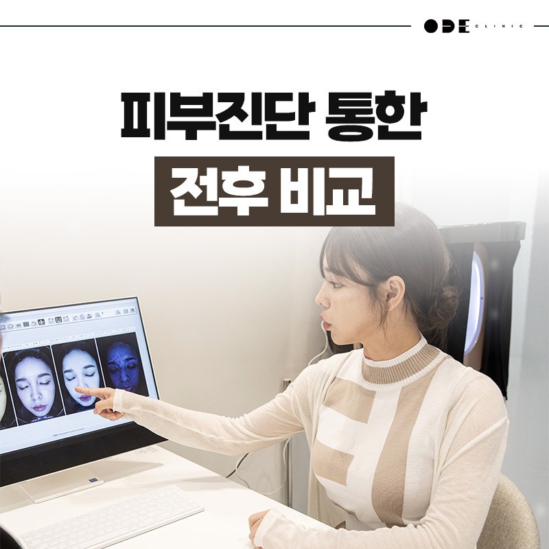 customized XERF treatments in Seoul
