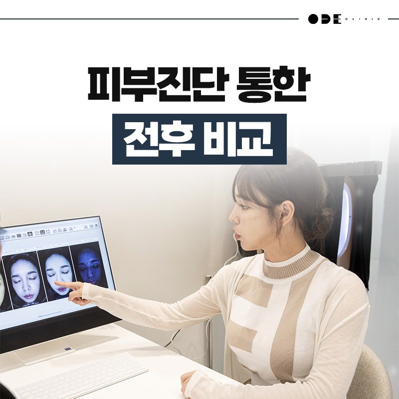 XERF consultation Seoul